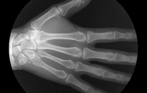 X-ray X-ray